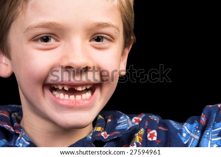 Young boy with beautiful green eyes who has one tooth missing