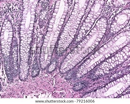 Glandular tissue at 20x Magnification