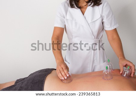 man with vacuum cups on her back at the health spa
