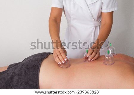 man with vacuum cups on her back at the health spa