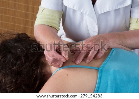 Bright caucasian woman receiving an acupuncture treatment in a health spa