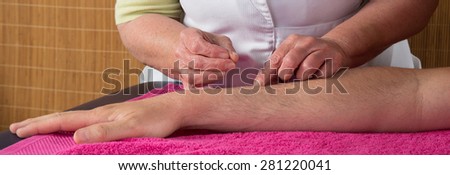 Treatment by acupuncture by a woman therapist