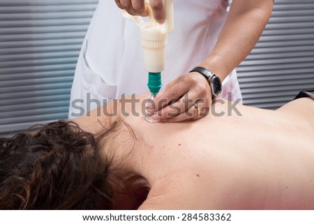 Detail of an acupuncture therapist removing a plastic  globe in a  cupping procedure