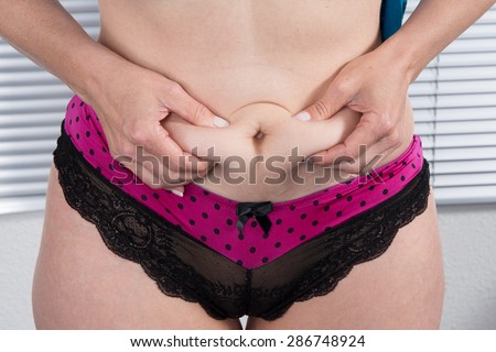 Woman showing Cellulite - bad skin condition on belly