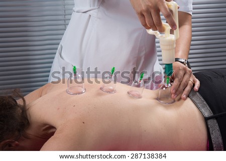 At spa center cupping, chinese medecine