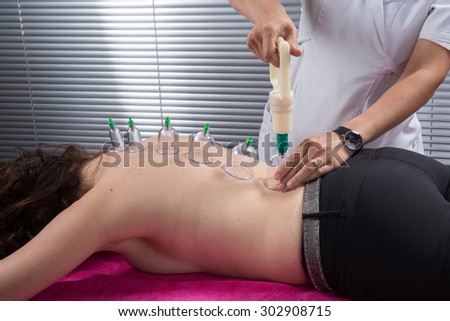 Cupping therapy, spa, woman doctor removes cups from the patient's back