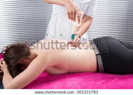 Cupping therapy, spa, woman doctor removes cups from the patient\'s back