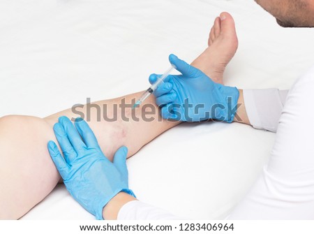 Doctor performs sclerotherapy for varicose veins on the legs, varicose vein treatment, copy space, injection