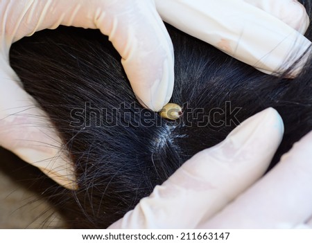 closeup of  an  adult tick on the dog  fur ; selective focus at dog tick
