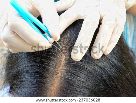 closeup of hands are removing grey hair of  asian old woman by using pliers ; selective focus