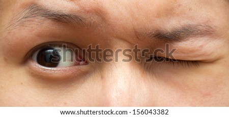 Close-up picture of brown eyes from a young man