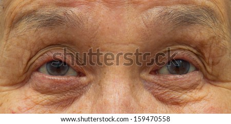 old woman eyes