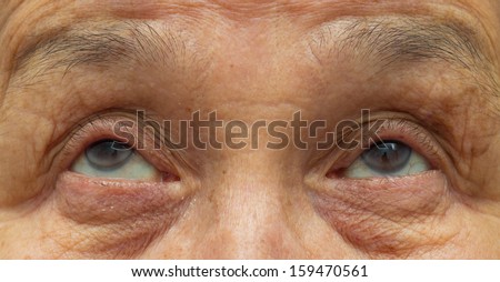 old woman eyes
