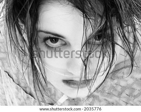 Teen in hospital gown with oxygen tube in black and white.
