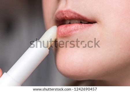 Chapped, or cracked, dry lips that have lost moisture. Woman maintains her lips. Lip Care.