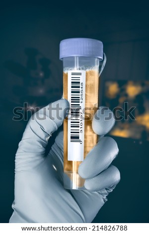 Gloved hand holds bar-coded liquid sample in microscopy room, toned image