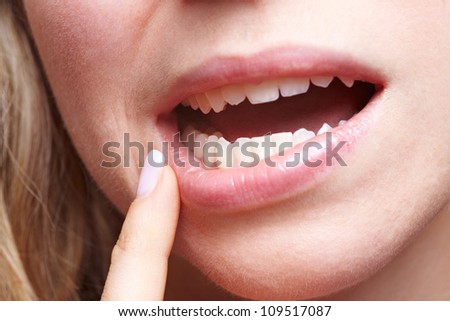 Woman with pain in her gums holding finger to mouth