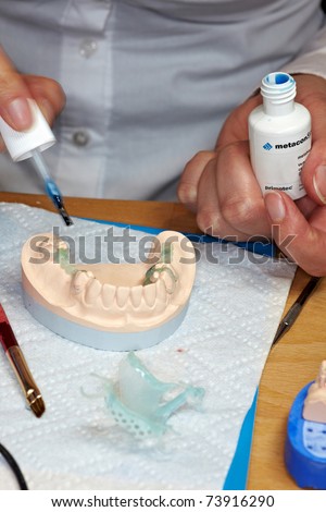 COLOGNE - MARCH 22: Demonstration of new light-curing modeling wax at the METACON booth at the IDS Dental Industry trade show in Cologne, Germany on March 22, 2011.