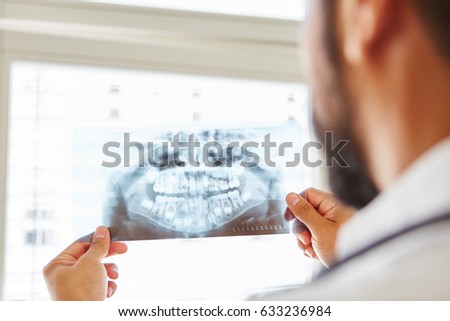 Doctor holding x-ray image from jaw and making diagnostic for oral surgery