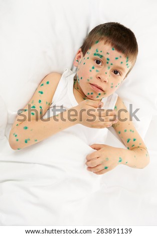 child has the virus on skin, white background