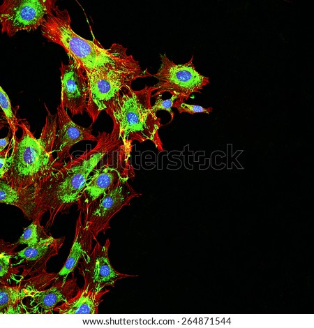 Imaging of metastatic cancer cells spreading on the surrounding tissue.