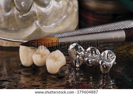 E-max pressed ceramic bridge and metal crown with dentistry utensils and mockup