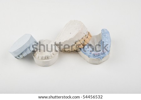 Two dental mouth mold small and big wiith false teeth