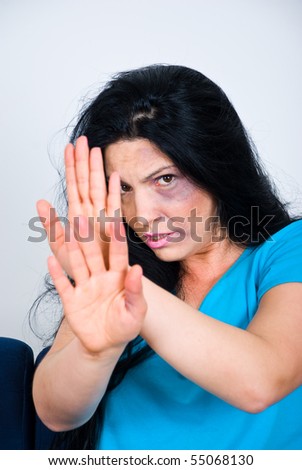 stock photo Abused scared woman with bruises on face sitting and showing 