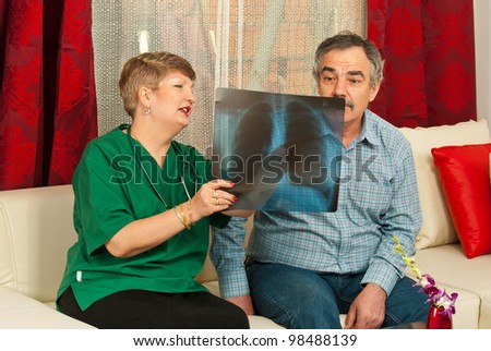Doctor woman showing x-ray to surprised mature patient male in his home