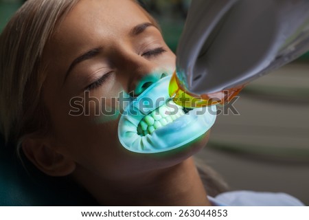 Human Teeth, whitening, Dentist.