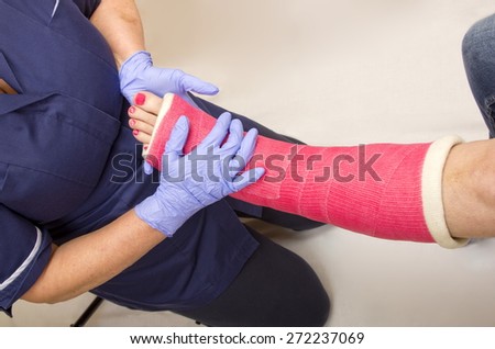 Ladies leg in Cast being treated by a Nurse\
A nurse treating a ladies fractured leg in a pink cast