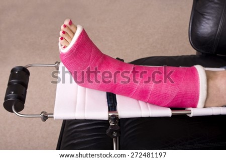 Lady with Fractured Leg A lady with a fractured leg sat in an armchair with her pink pot on a raised leg support