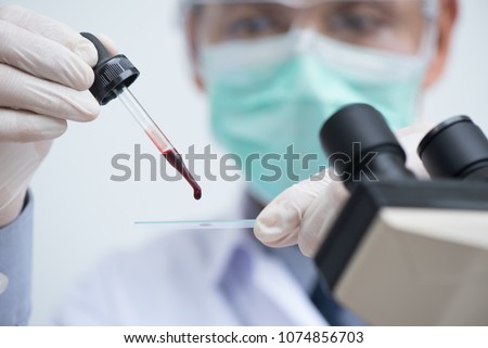 Doctor or lab technician dripping human red blood on slide glass for malaria test (thick film), blood group test, complete blood count (CBC) with microscope in hospital laboratory. close up