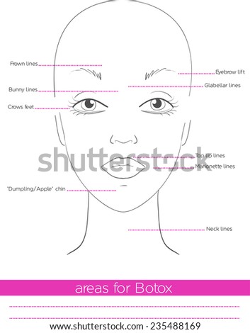 areas for botox
