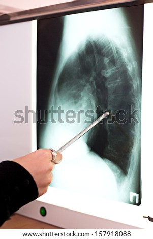 Medicine lab doctor pointing on x-ray bone no face