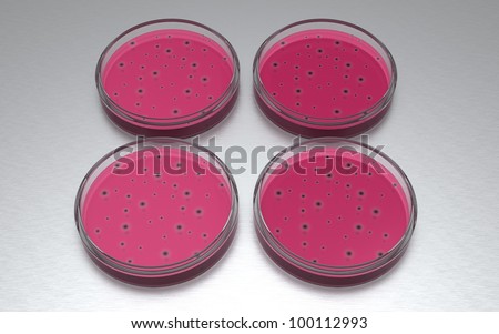 A set of petri dishes showing bacteria growth in the growth medium