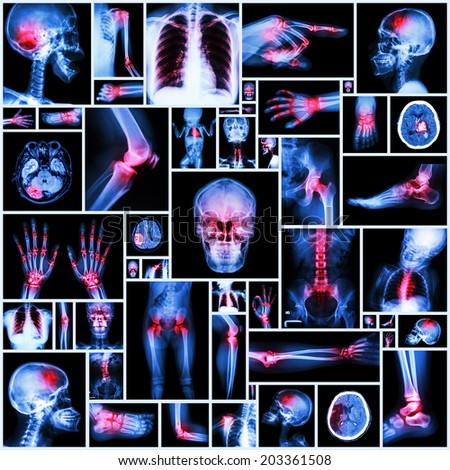 Collection X-ray multiple organ and arthritis at multiple joint (Rheumatoid,Gout)