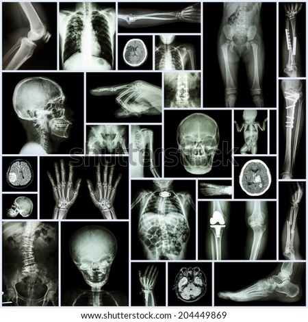 Collection X-ray \