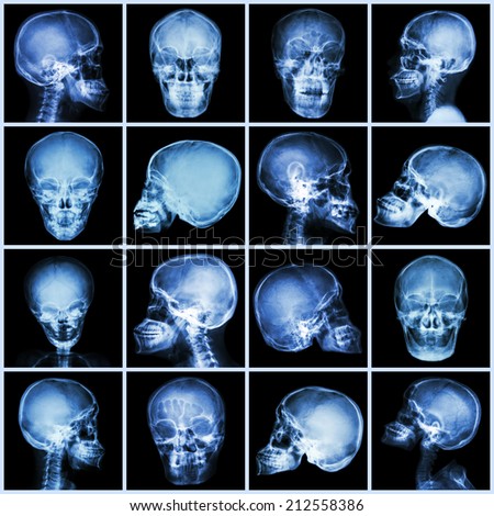 Collection x-ray skull (asian people)