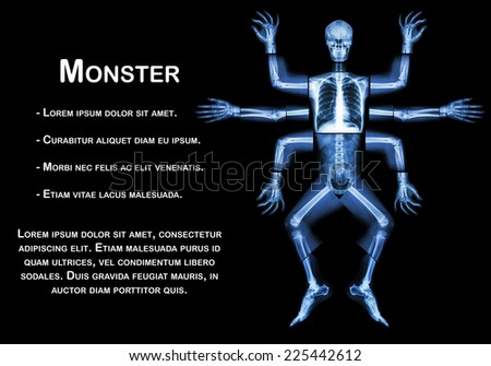 Monster have many arm. (X-ray whole body : head neck shoulder arm forearm elbow wrist hand digit thorax rib lung heart spine abdomen pelvic hip thigh leg knee ankle heel foot)
