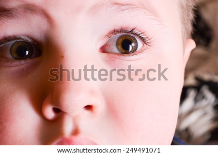 red eyes of a child. Boy with conjunctivitis. Little boy with having spring allergy. Fear of the child