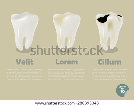 set of realistic tooth including healthy tooth and decayed tooth, dental health info graphics