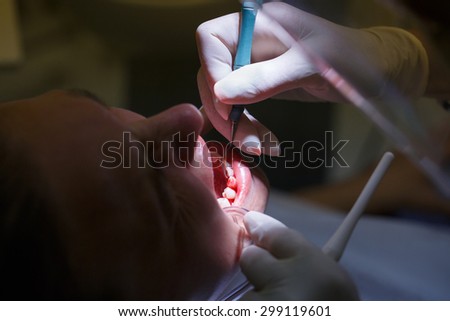 Patient at dental hygienists office, getting teeth cleaned of tartar and plaque, bleeding, preventing periodontal disease. Dental hygiene, painful procedures and prevention concept.