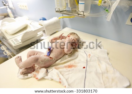 Vernix covered, big newborn with a lot of hair, lying on a table under the light, just after he was born, being assessed by midwife in delivery room in hospital. New life, health assessment concept.