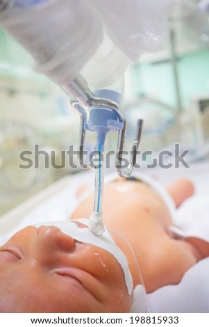 BANGKOK THAILAND-6 JUN 2014 A newborn baby was intubated and put into mechanical respirator and incubator BANGKOK THAILAND-6 JUN 2014 A newborn baby was intubated and put into mechanical respirator and incubator