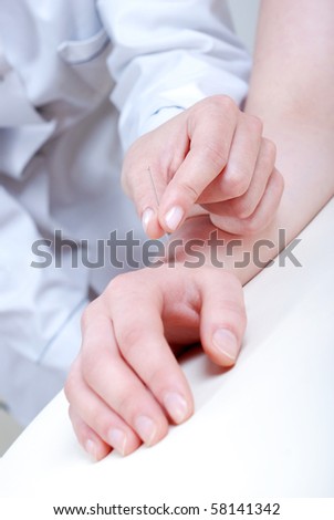 Acupunctured hand on the white background