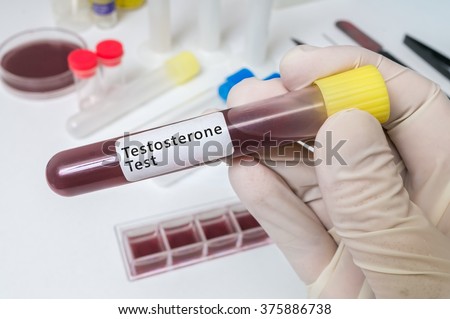 Hand holds test tube for testosterone test.