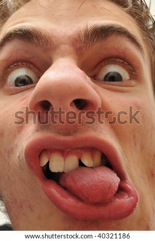 Crazy wacky ugly man with crooked teeth and acne and veins above his eyes