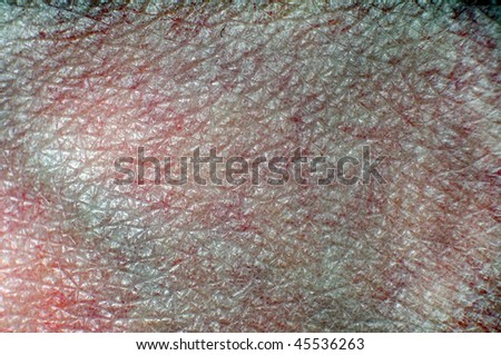 This is a rough skin texture. You can see each individual cell and see the bold blue blood vessel veins faintly against the skin.