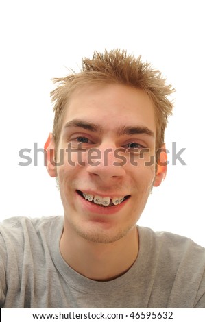 scarlett johansson teeth crooked. braces Teeth+braces+funny